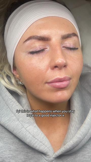 @clubskinuk