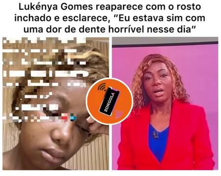 @ZONGOLA