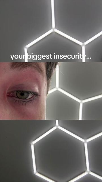 @Nick