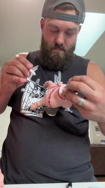 @Limb Loss Boss