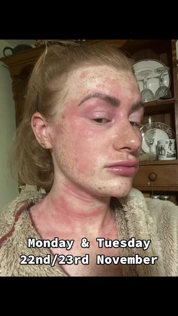 @my journey to repair my skin