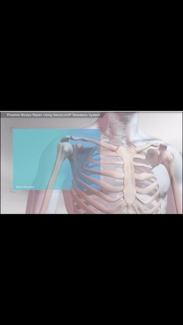 @Anatomias