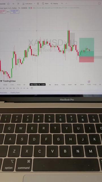 @Rayyanxauusd