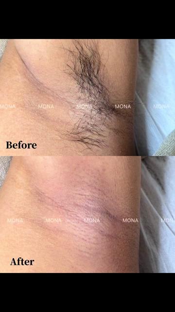 @MONA SKIN LASER & BEAUTY