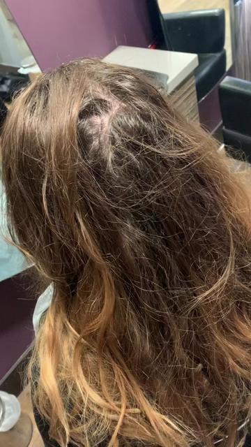 @Fusionhairconsultants