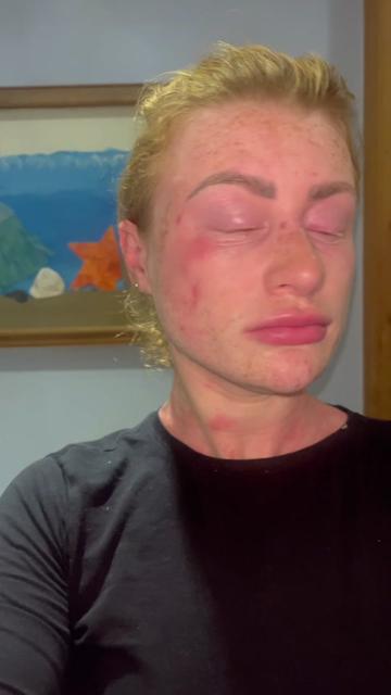 @my journey to repair my skin