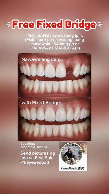 @Kaye Peña Abad