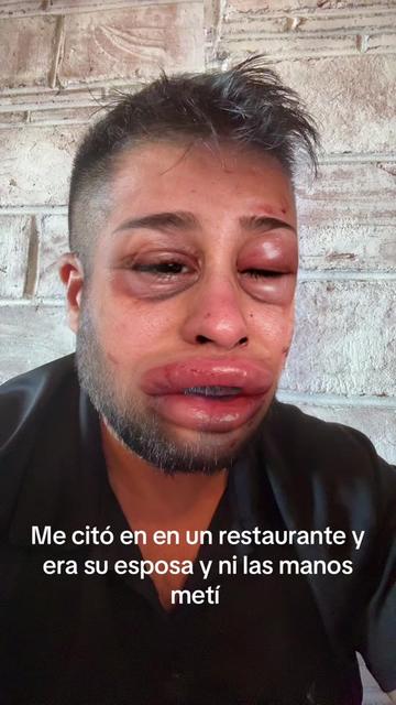 @Gabriel Itto