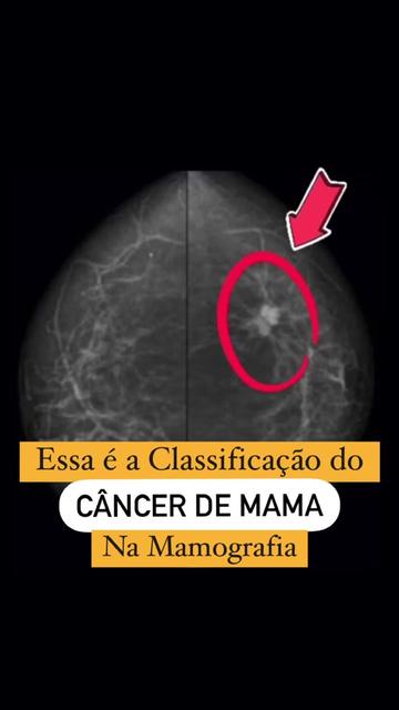 @Dr Jeferson Baggio Oncologista