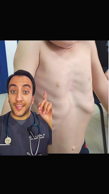 @DrCarlosAguilar Cirujano niños