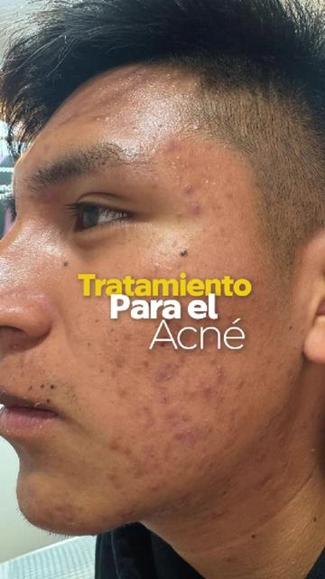 @RebellSpa