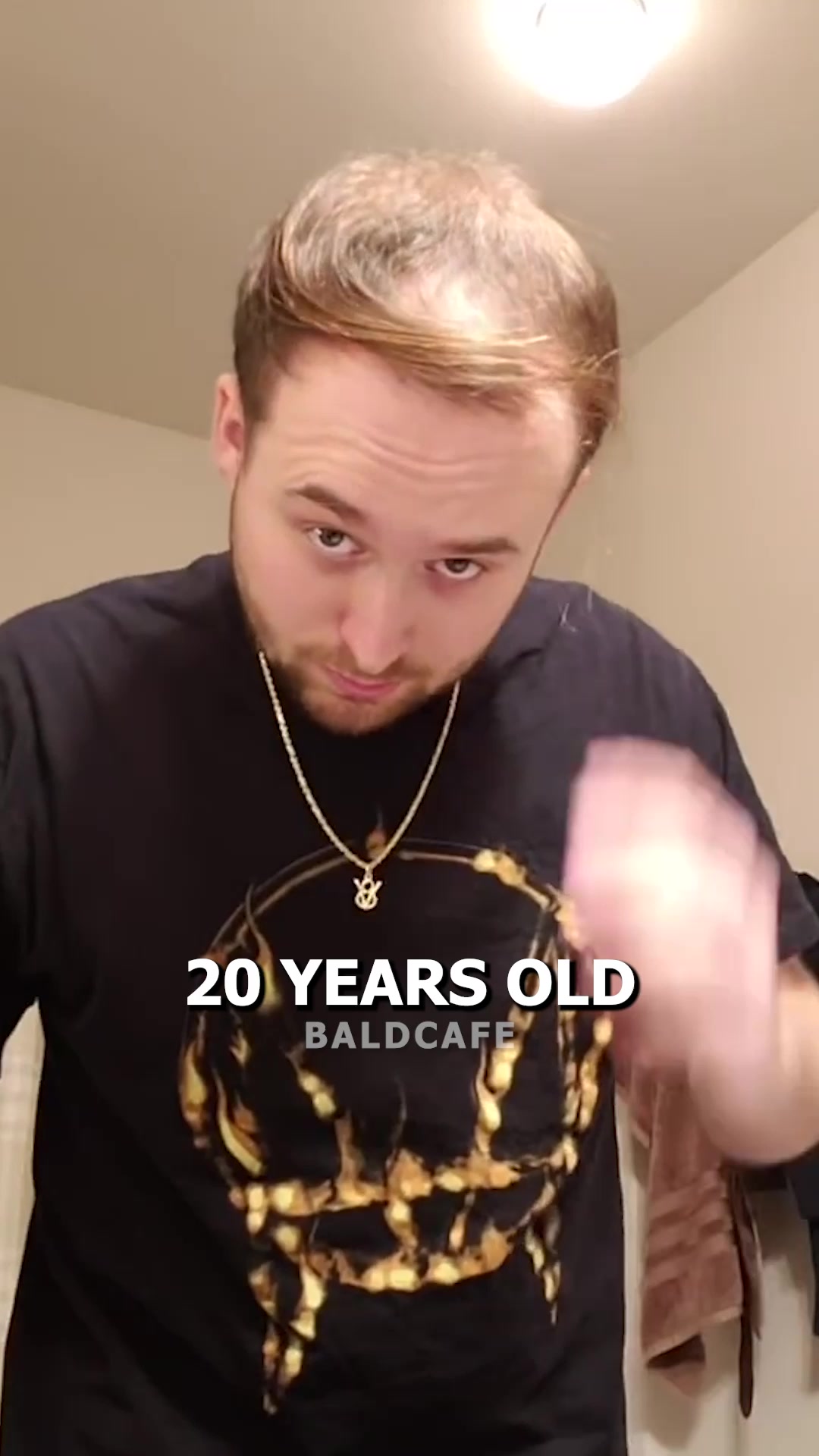 @Baldcafe_official