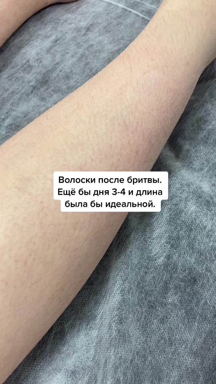 @Шугаринг Сергиев Посад