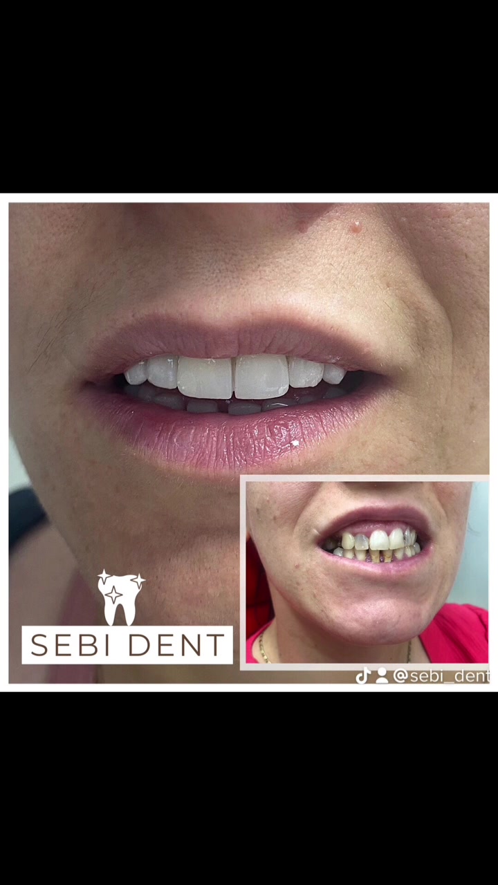 @sebi dent