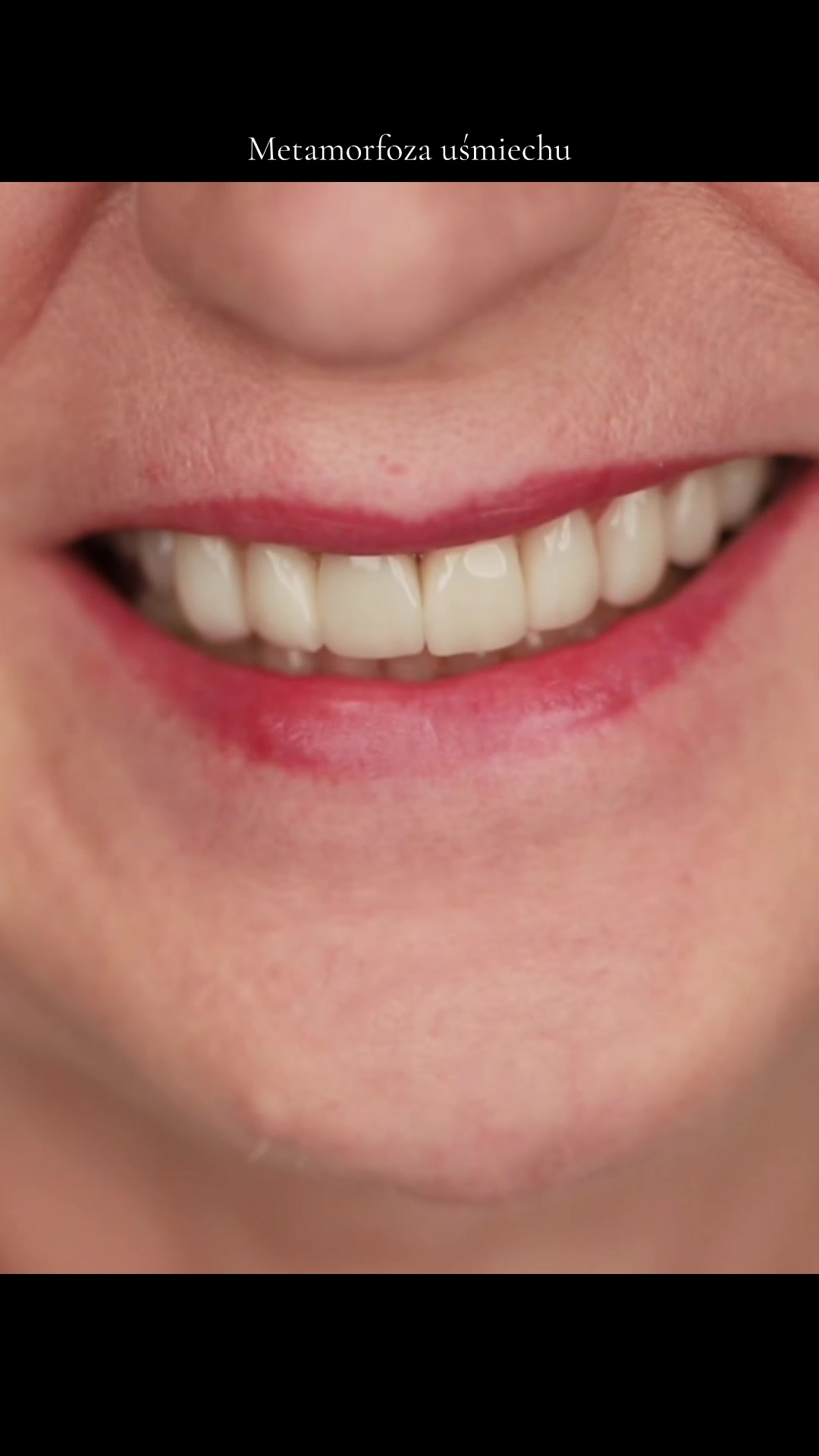 @Anna 🦷 dentystka