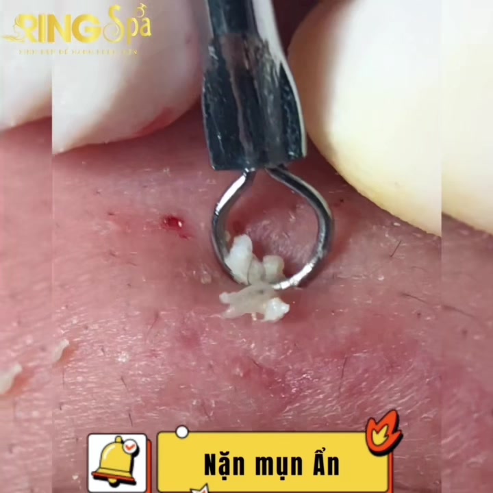 @Ring_Spa