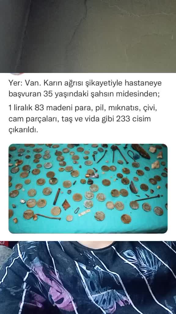 @GFBkerem