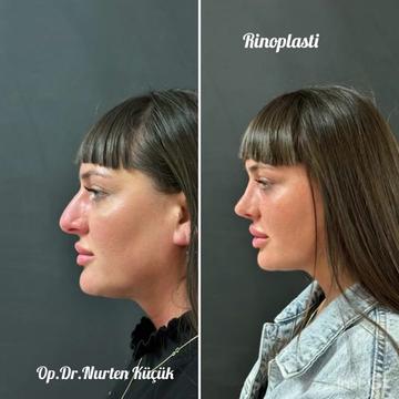 @Dr. NurtenKucuk