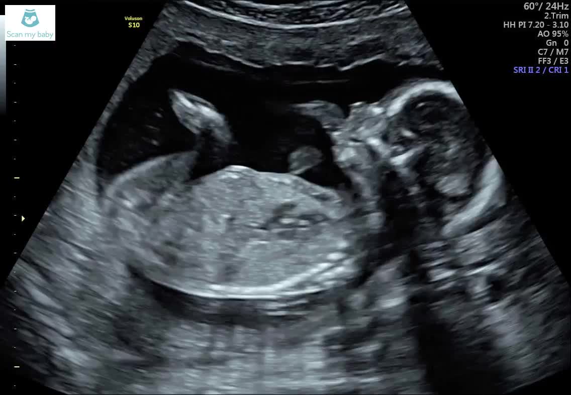 @Jen
