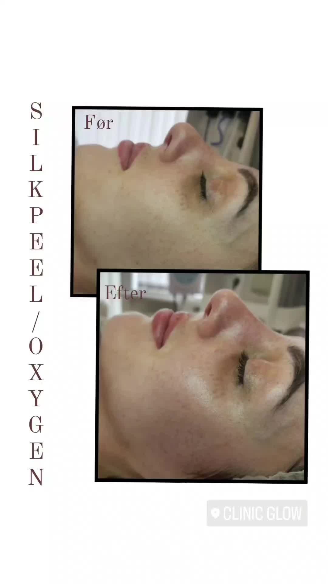 @Clinicglowdk