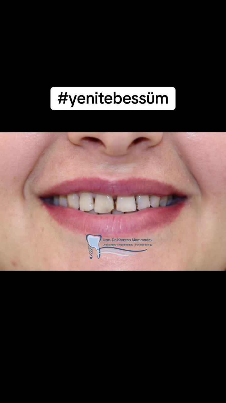 @dr.kamranmammadov