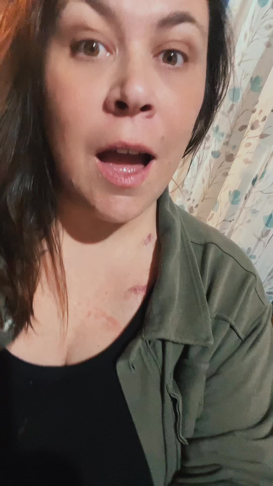 @caseync03