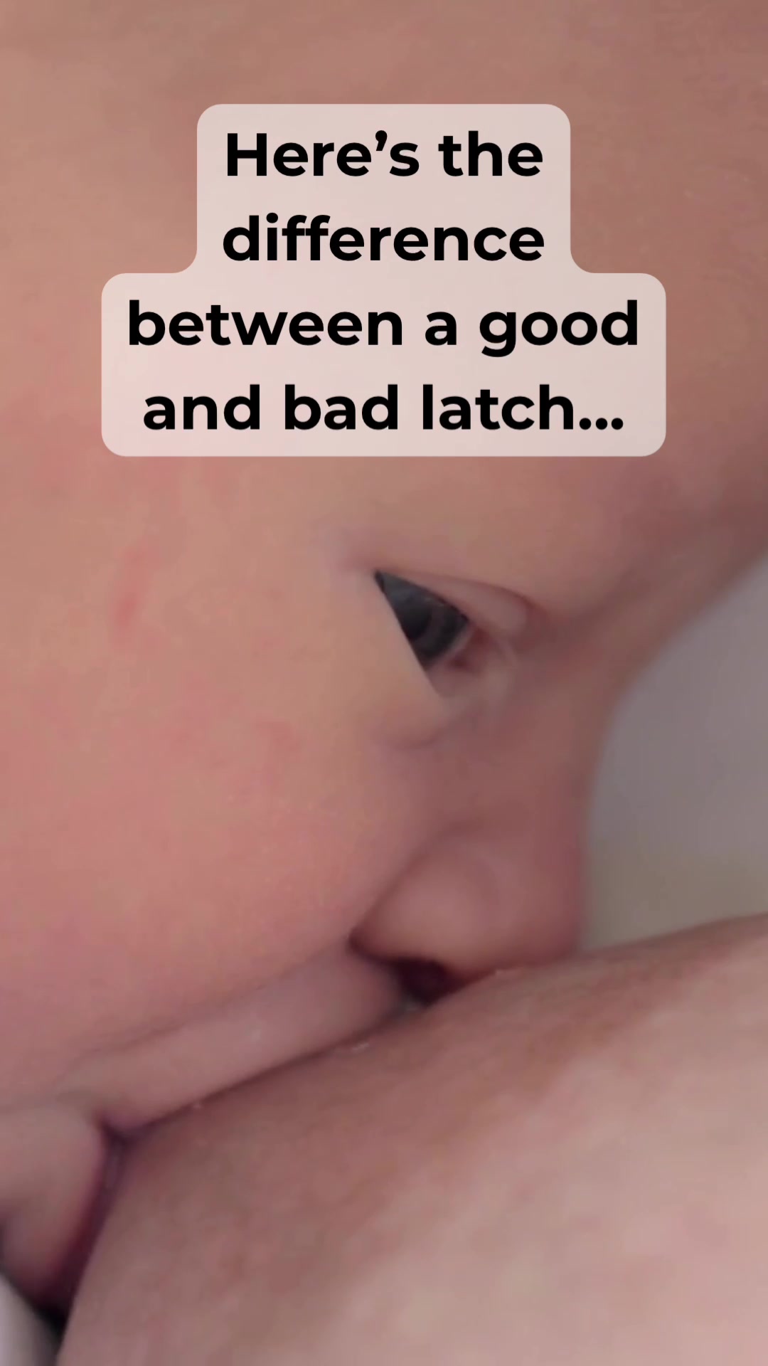 @The Colic Mama