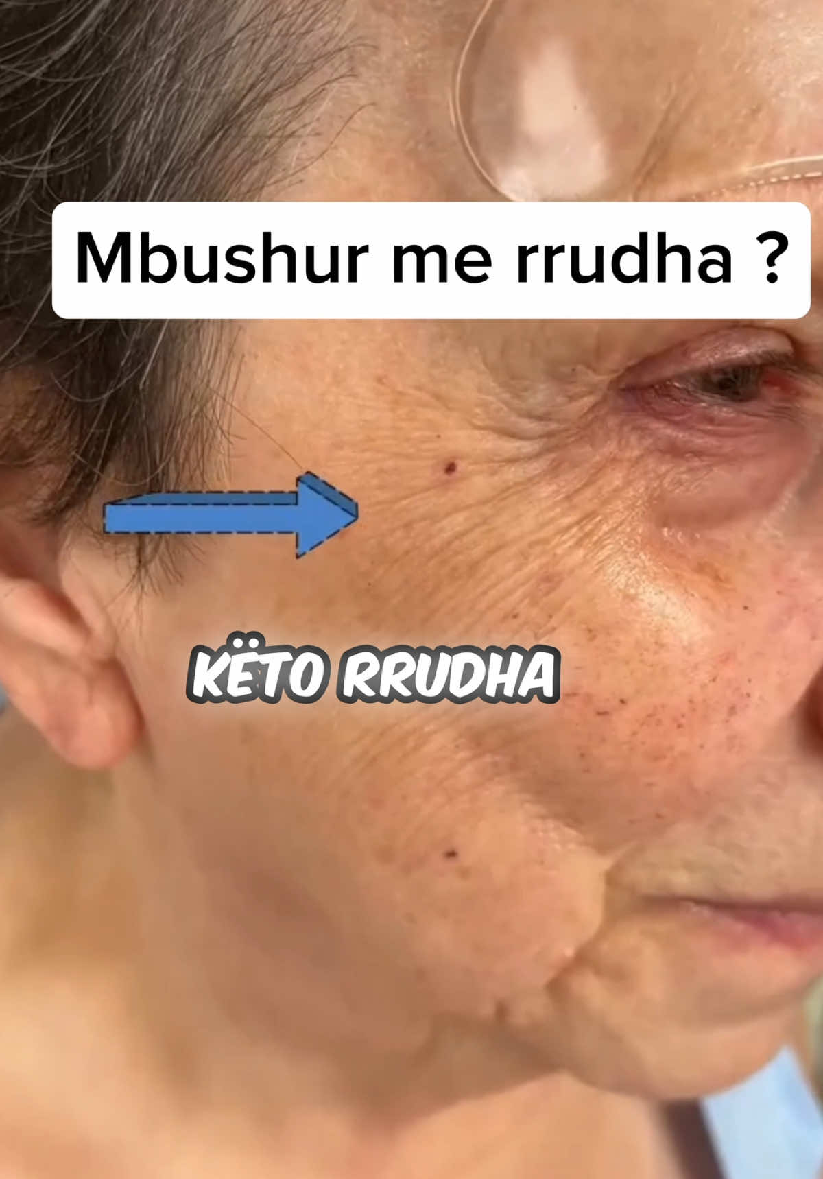 @Lumar