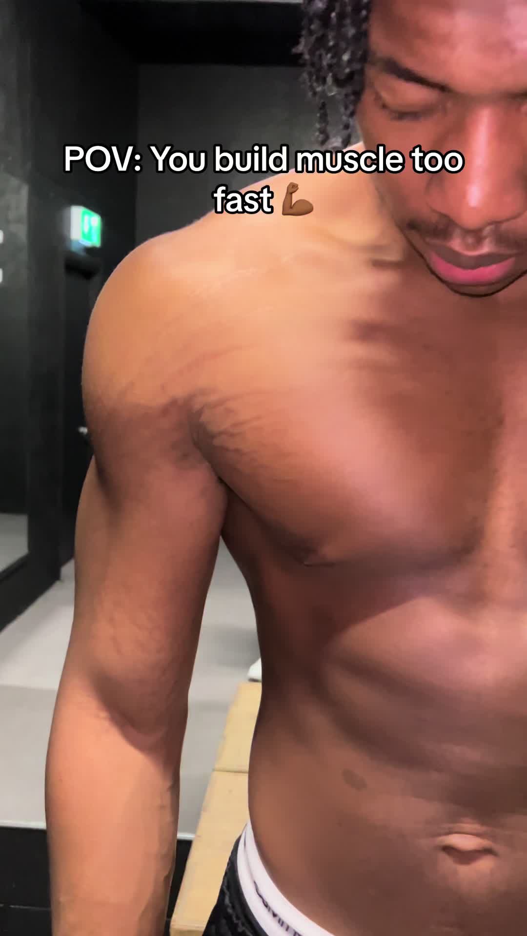 @Stretch marks guy