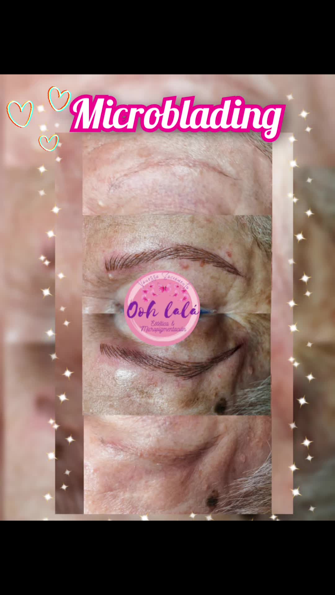 @Oohlal&aacute; Est&eacute;tic