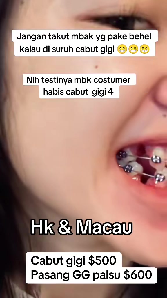 @mbak-Paijem