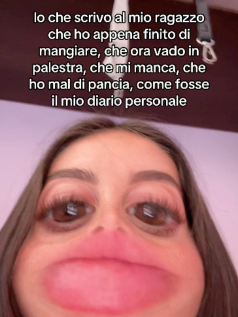 @Gaia Vetromile