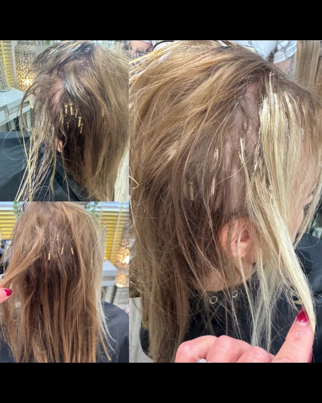 @Godiva Hair Loss Specialists