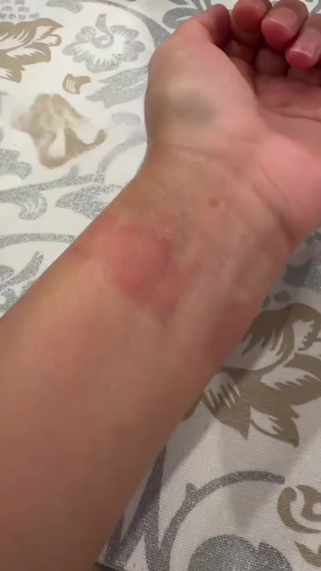 @Ignovys