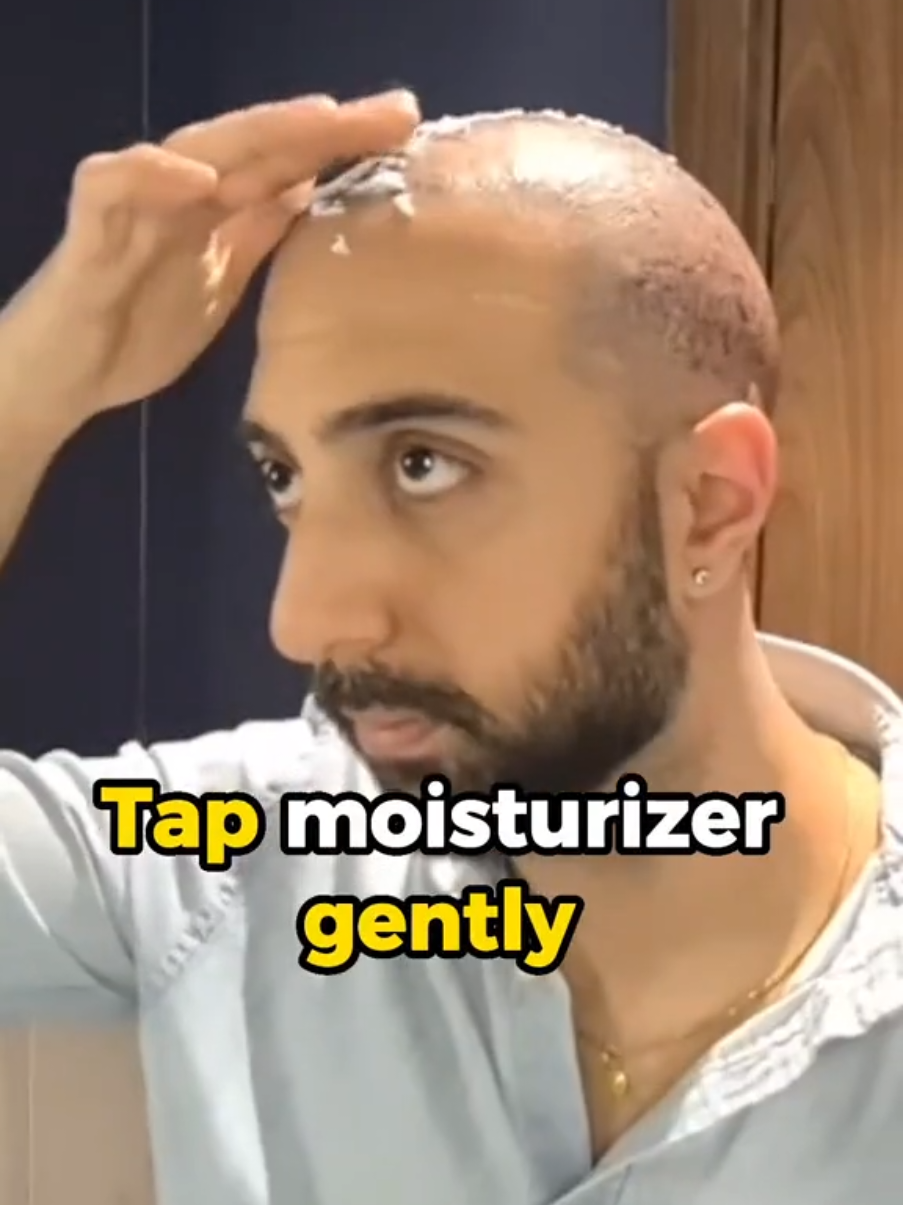 @Amit | Hair Transplant Tips