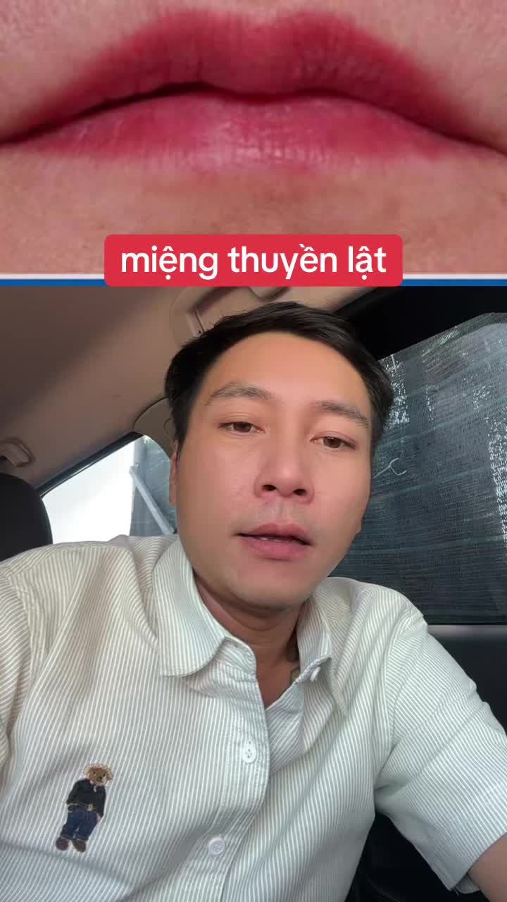 @Tuệ Nhãn ✅