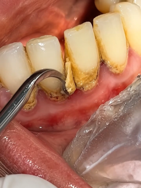 @DentalTreatment