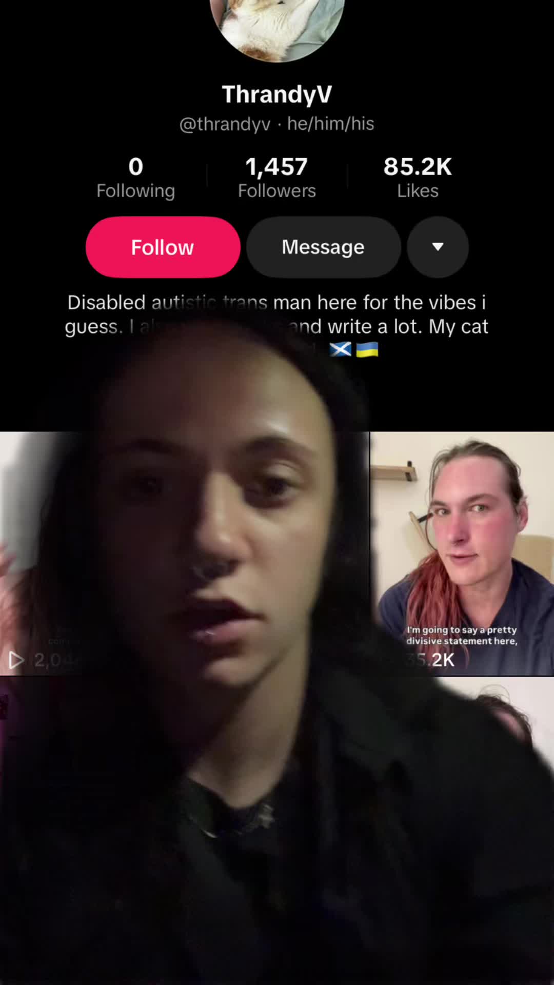 @boycervix