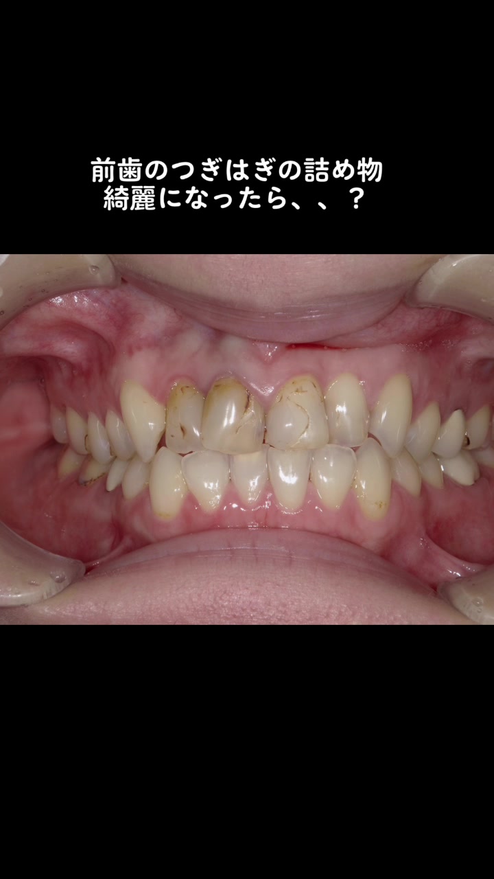 @DentalClinicPURE