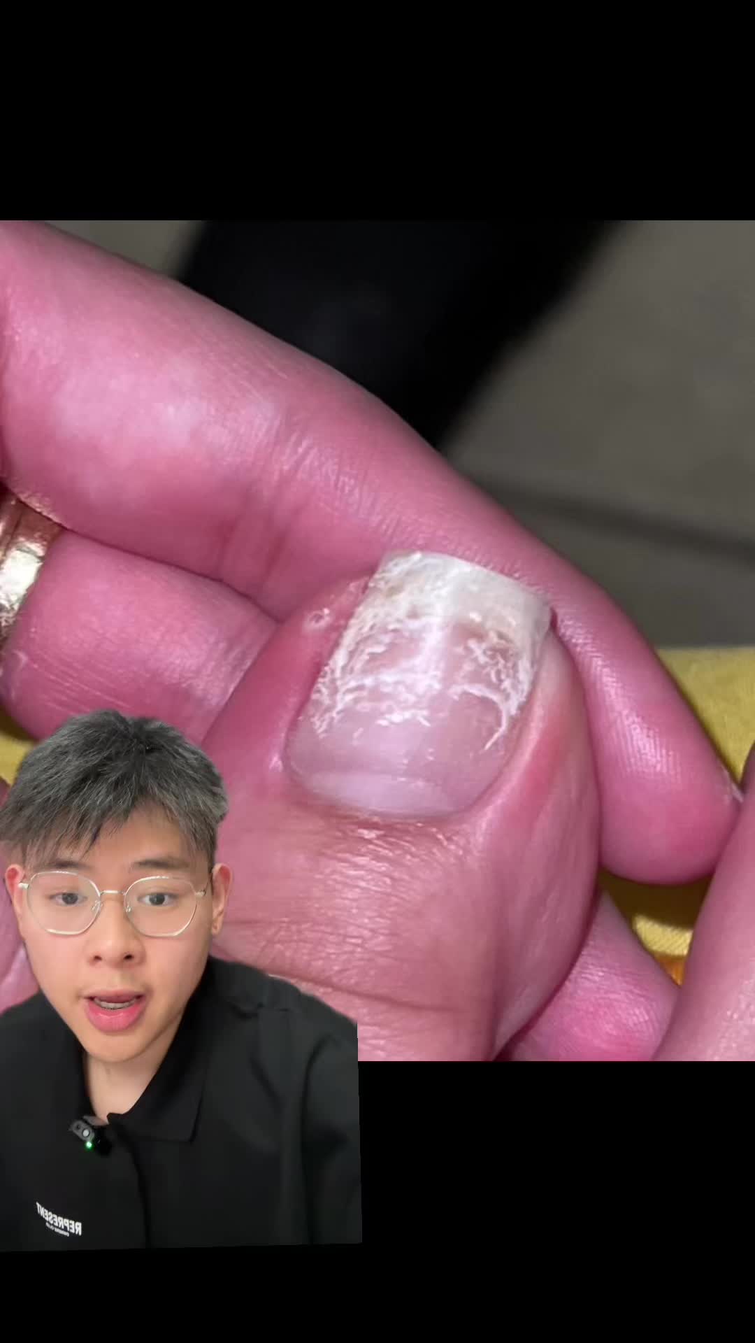 @Dental Nail Art