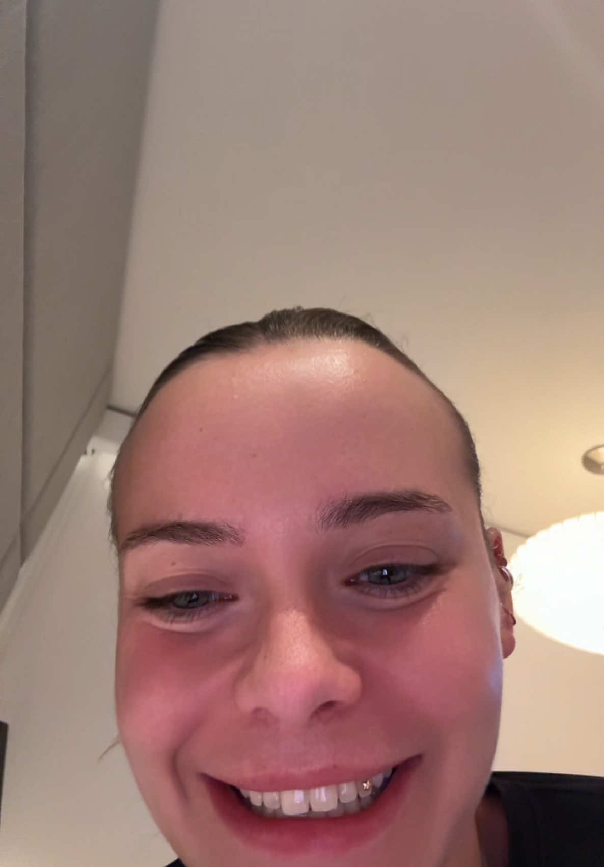 @skøien