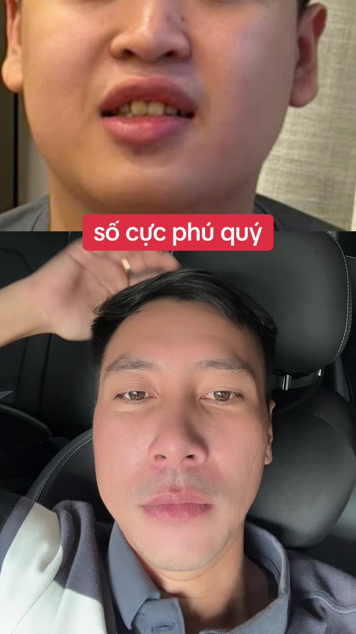 @Tuệ Nh&atilde;n ✅