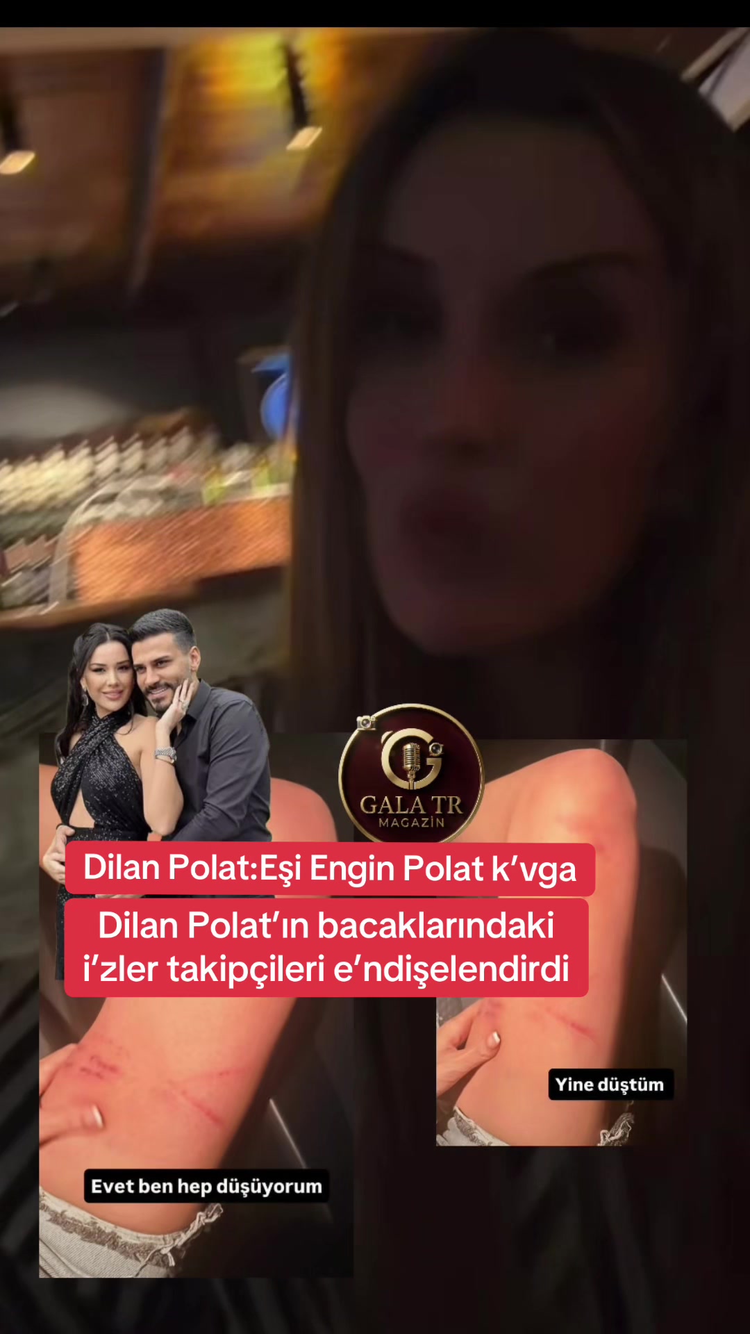 @GALA TR_MAGAZİN