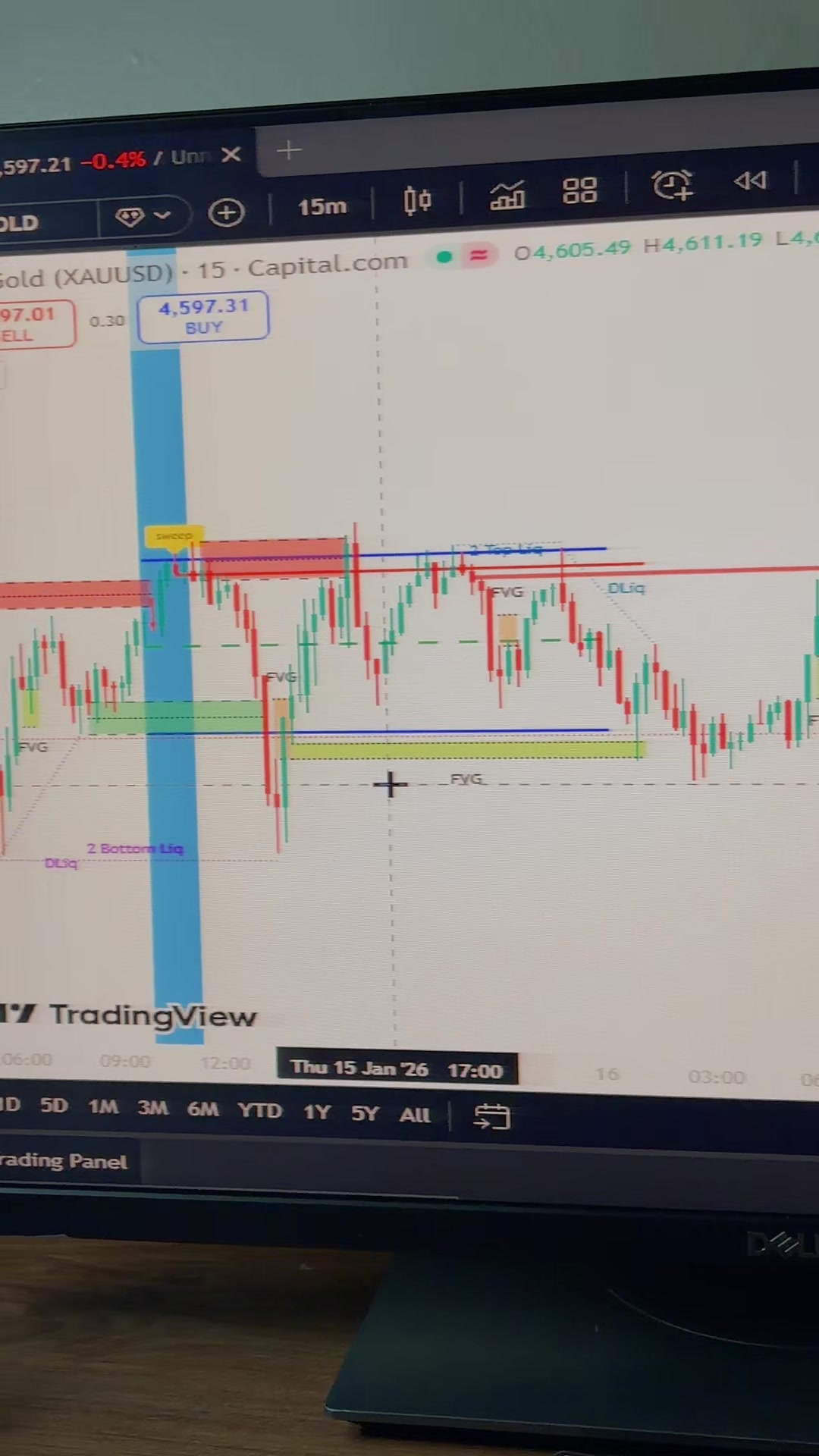 @Rayyanxauusd