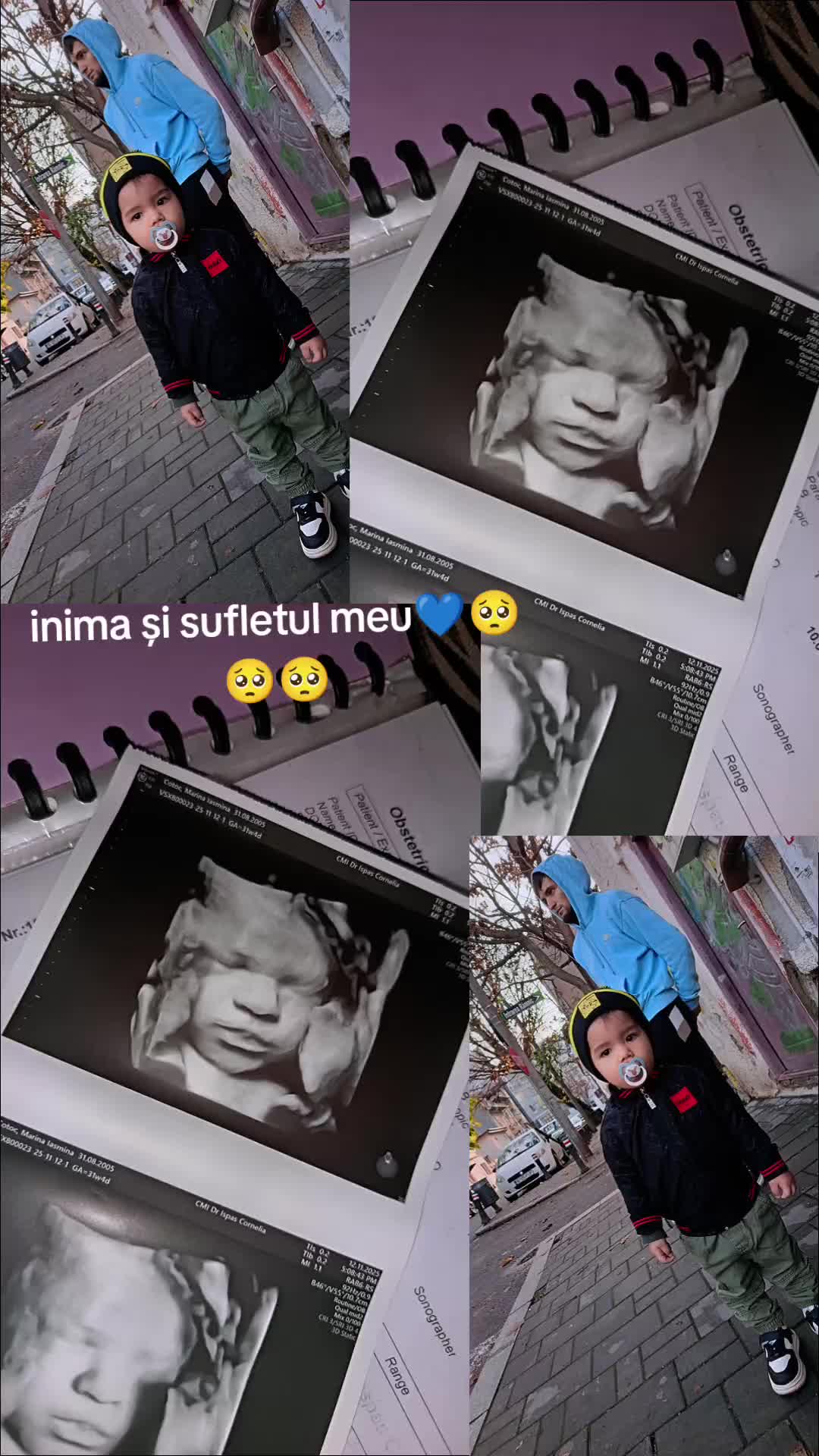 @A&Y🥺🫶❤️&zwj;🩹