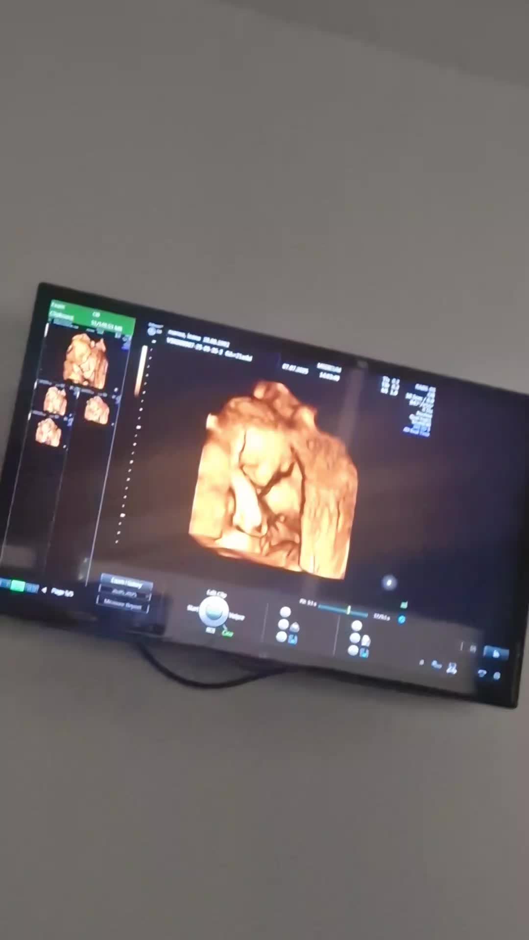 @0aNa