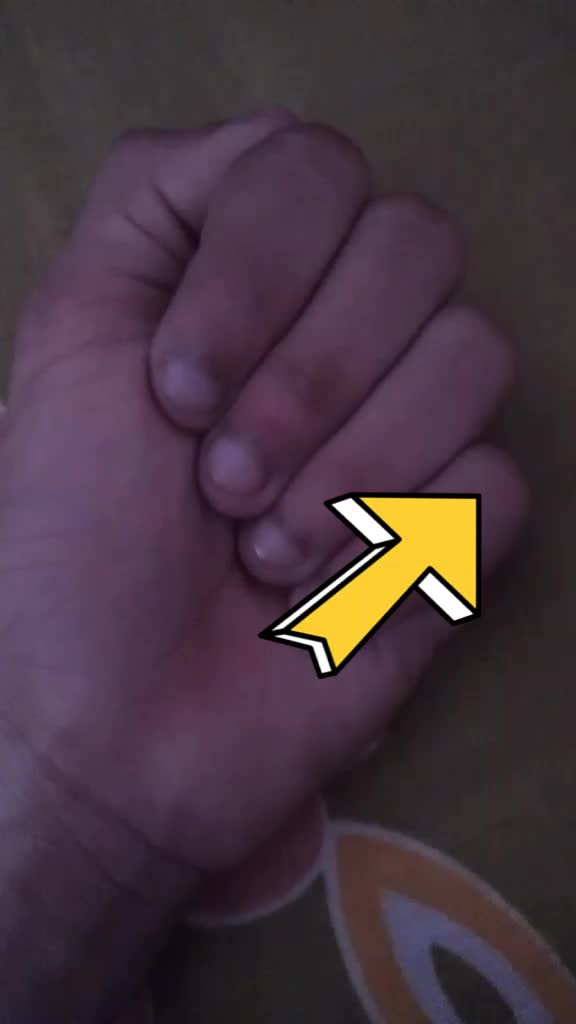 @DEVASOORYA3982