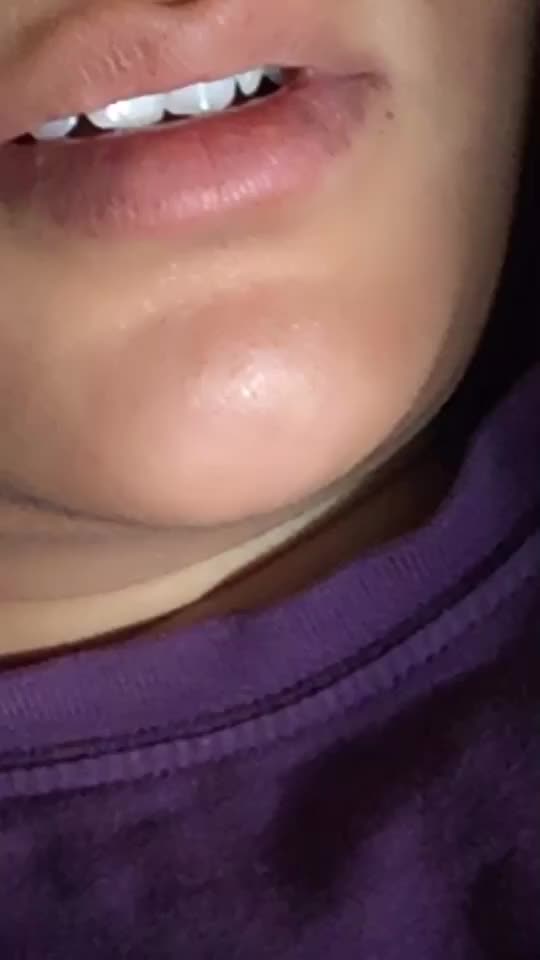 @RLR 0110