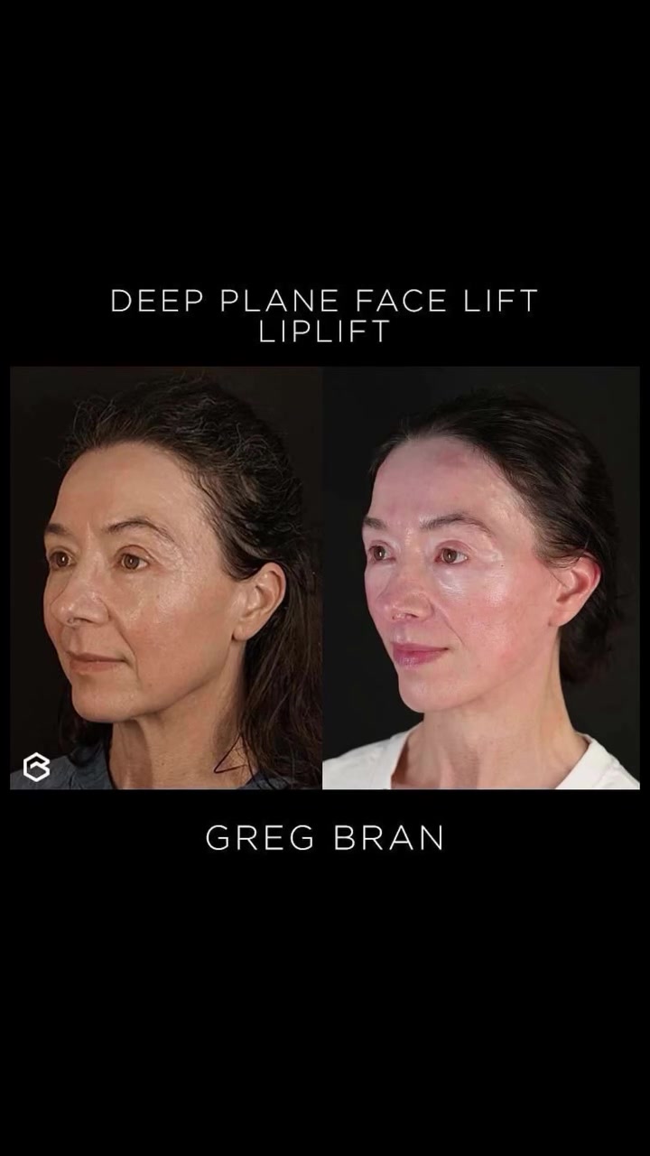 @drgregbran
