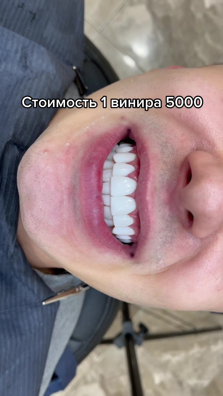 @Royal_smile_moscow